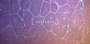 Descubra cómo el NMN combate los problemas hepáticos relacionados con el envejecimiento reduciendo el estrés oxidativo y mejorando la resistencia del hígado a través del eje Sirt3-Nrf2.