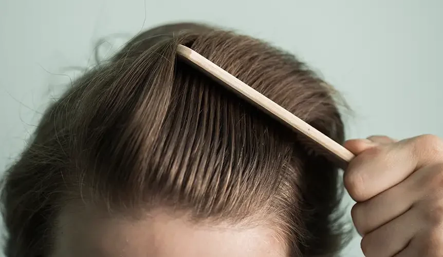 Close-up of a person combing back their light brown hair with a wooden comb, revealing the hairline and scalp.